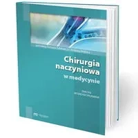 Chirurgia naczyniowa w medycynie