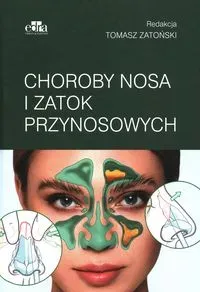 Choroby nosa i zatok przynosowych