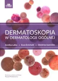 Dermatoskopia w dermatologii ogólnej