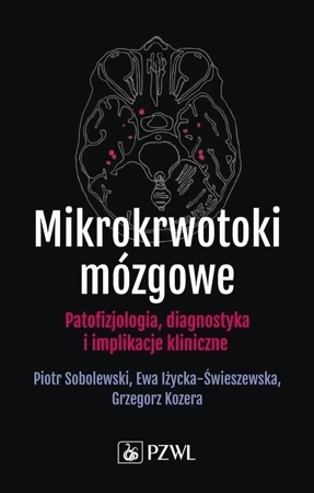 Mikrokrwotoki mózgowe. Patofizjologia, diagnostyka i implikacje kliniczne