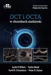 Oct i octa w chorobach siatkówki